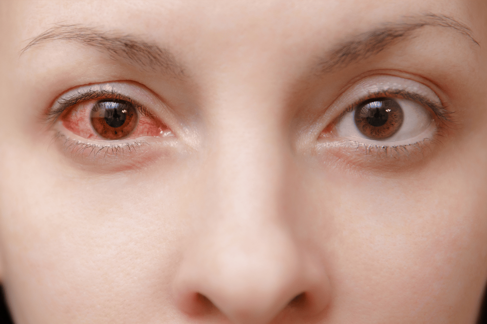 enfermedades-oculares-relacionadas-con-diabetes-salud-humana