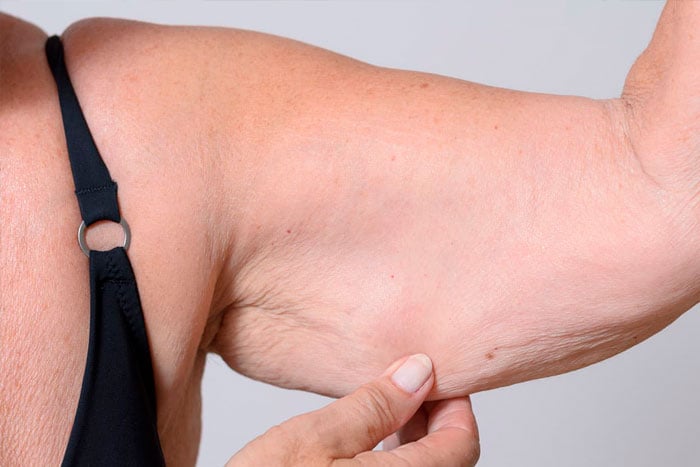 sarcopenia-perdida-masa-muscular-con-la-edad-blog-salud-humana